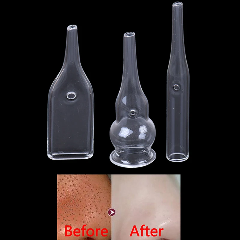 3Pcs/Set Blackhead Removal Glass Pipes Face Pore Cleanser Vacuum Extractor Tube