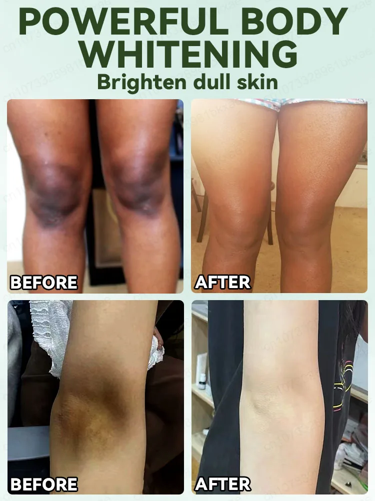 ᵂʰⁱᵗᵉⁿⁱⁿᵍ ᵒⁱⁿᵗᵐᵉⁿᵗ ᵉᶠᶠᵉᶜᵗⁱᵛᵉˡʸ ʷʰⁱᵗᵉⁿˢ ˢᵏⁱⁿa7gT3kP9rL2sQ5dF8mZ1hB4vN6wX0zC7xK3pM9qR2tS5