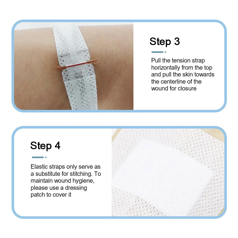 1Pc Zipper Tie Wound Closure Patch Zipper Band-Aid Wound Fast Suture Outdoor Portable Hemostatic Patch First Aid Tool