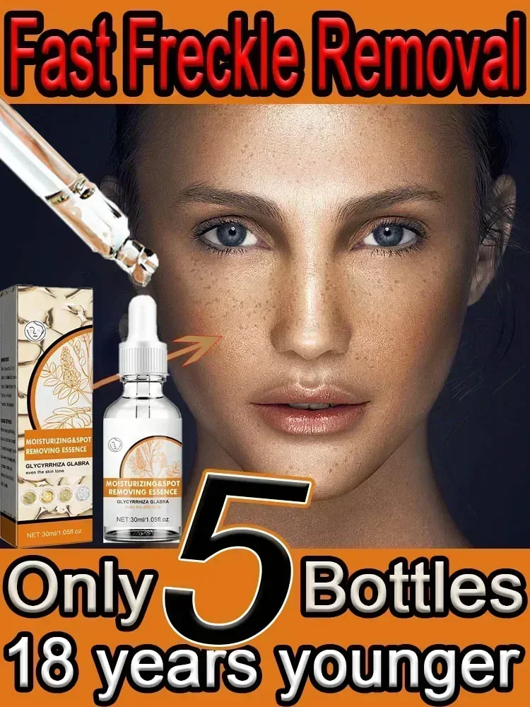 

Facial Whitening Serum Removes Melanin Age Spots And Freckles Reduces Dullness Moisturizes Brightens New1