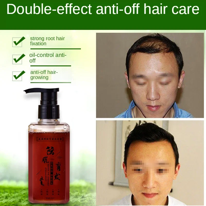 300ml Anti Hair Loss Ginseng Shampoo Professional Regrowth Treatment Thickener Thinning Hair Polygonum Hair Growth Liquid