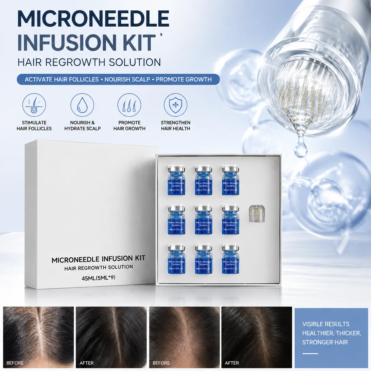 Microneedle Hair Regrowth Kit 0.25mm Essential Serum Hair Follicle Scalp Nourishing Strengthen Roots Hair Thicken Conditioner
