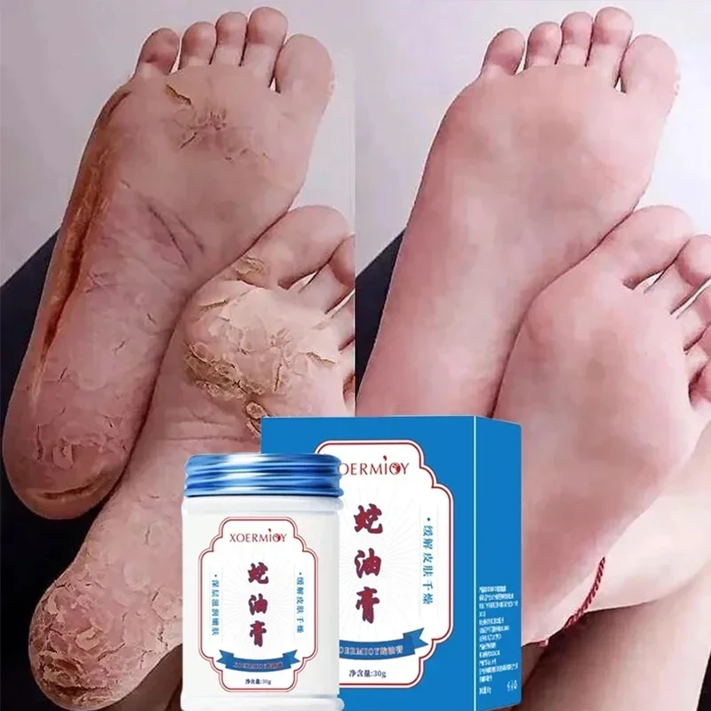 Herbal Anti Crack Foot Cream, Heel Cracking Repair Products, Esfoliação Dead Skin Removal, Suavização Hidratar, Smooth Skincare