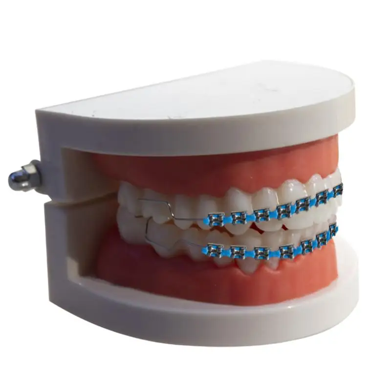 

1 Pair Temporary Tooth Decoration Orthodontic Ligature Ties With Metal Wires Orthodontic Ligature Ties Dental Accessory
