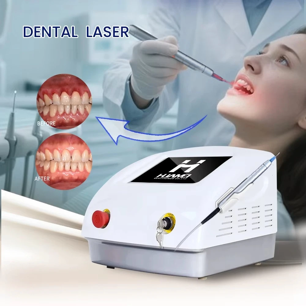 

Wholesale Price Soft Tissue Cutting Dental Laser Teeth Whitening Laser Gum Treatment Periodontal Therapy Machine