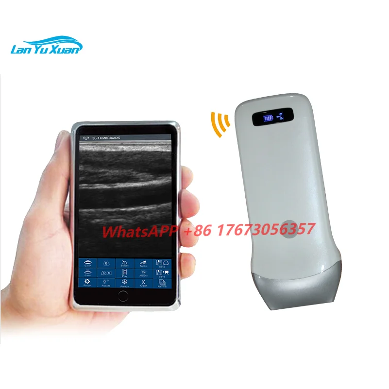 Medical Devise Mini Portable Wireless Handheld Convex Linear Probe Ultrasound Scanner Black and white linear array basic model