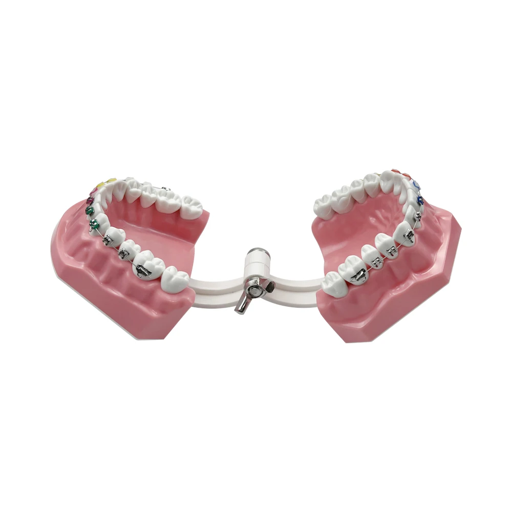

Orthodontic Teeth Model With Self Ligating Metal Bracket Ceramic Braces Typodont Demonstration Tools For Patient Communication
