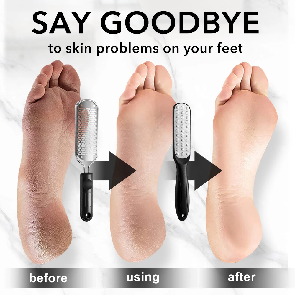 2 ピース/セット足ファイルカルスリムーバーステンレス鋼足やすりプロフェッショナルスクラバーペディキュアツールプレミアムフットケアツール