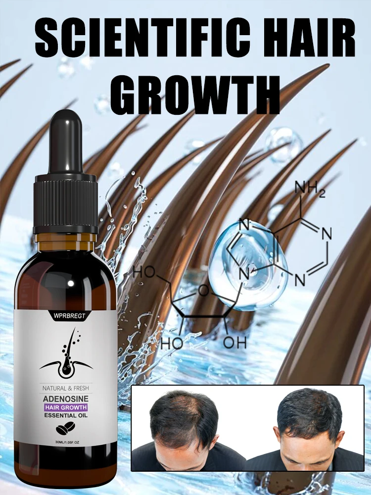 Hair Growth Essence Oil Products Effective Baldness Fast Repair Treatment Anti Hereditary Seborrheic Alopecia Loss For Men Women