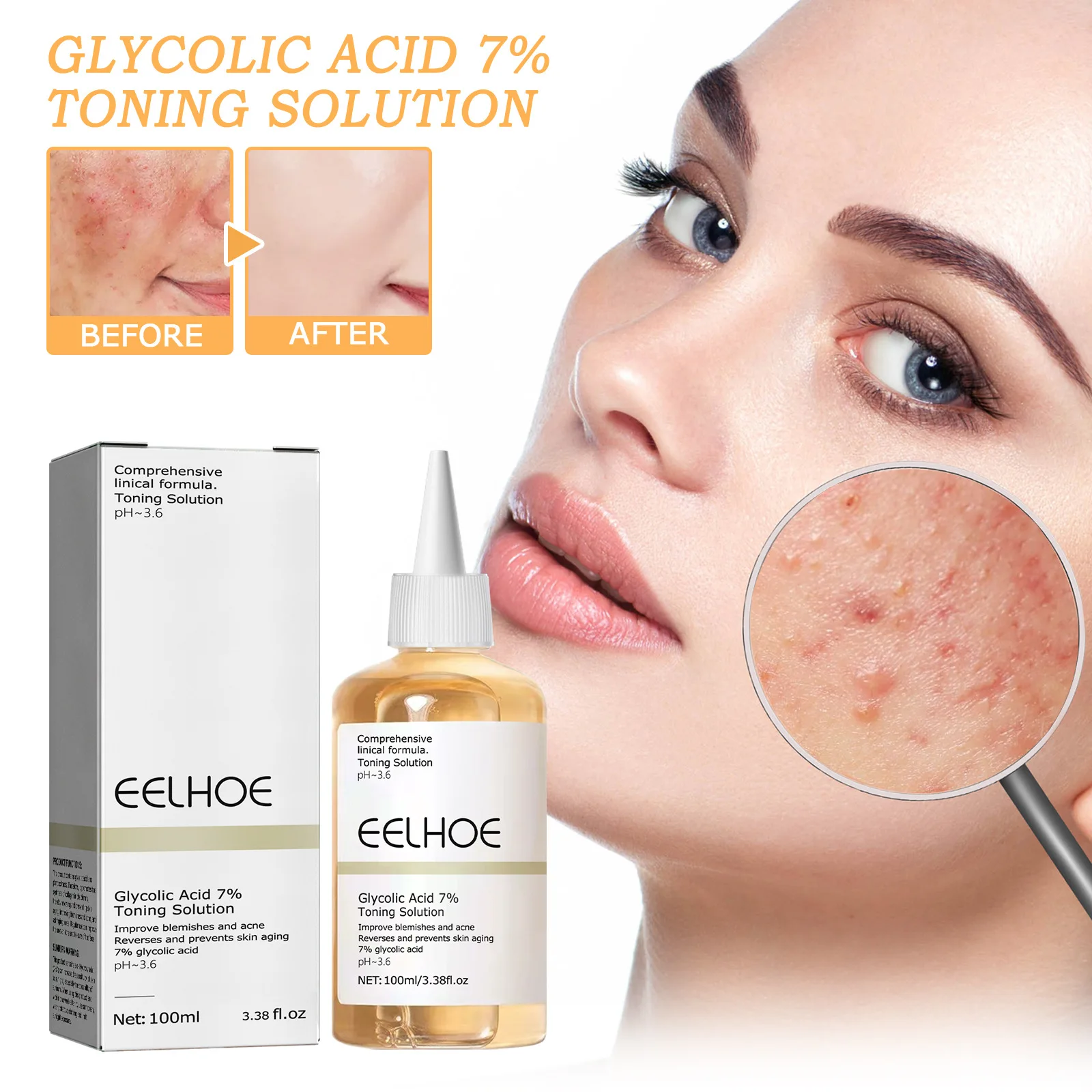 EELHOE Glycolic Acid 7% Toner for Acne Removing Closed mouth Acne Repairing Moisturizing & Nourishing Skin