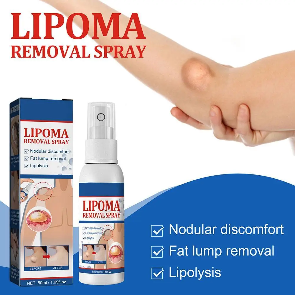 50ml Lipoma Removal Spray Skin Repair And Deep Penetration Cellulite Lotion For Fat Hard Lumps