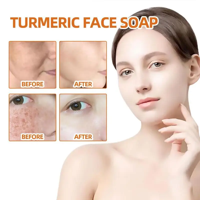 Turmeric Soap Bar for Face & Body Hyperpigmentation Natural Handmade Soap Brightens Skin Evens Tone Fades Scars Age Spots