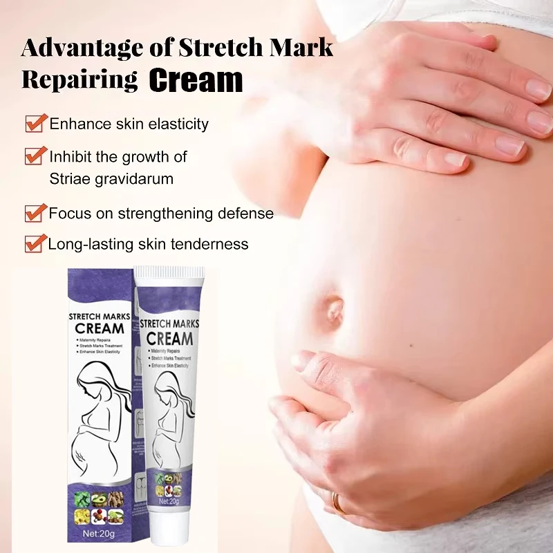 21Stretch Mark Removal Cream Postpartum Repair Cream For Pregnant Women Obesity Mark Growth Marks Thigh Firming Skin