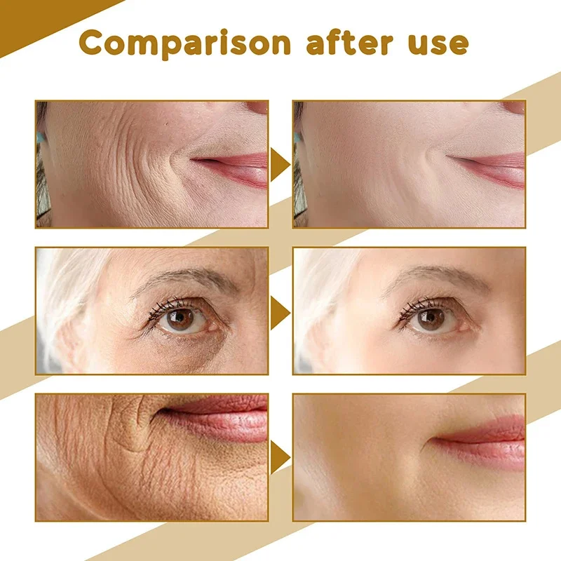 เซรั่มใบบัวบกบำรุงผิวแห้ง ผิวเรียบเนียน ฟื้นฟูผิว ครีมบำรุงผิวหน้าขาวกระจ่างใส มอยเจอร์ไรเซอร์เกาหลี