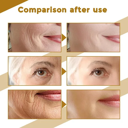 Imagen 2 del producto Centella Asiatica suero Facial nutre la piel seca suavizante rejuvenecimiento brillo de la piel crema blanqueadora hidratante Facial coreano