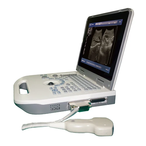 

Cheapest medical full digital portable b/w 3d black and white ultrasound scanner