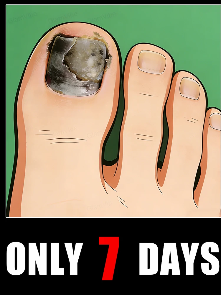 

Поломте от тусклых желтых ногтей, блестящие кончики пальцев яркие