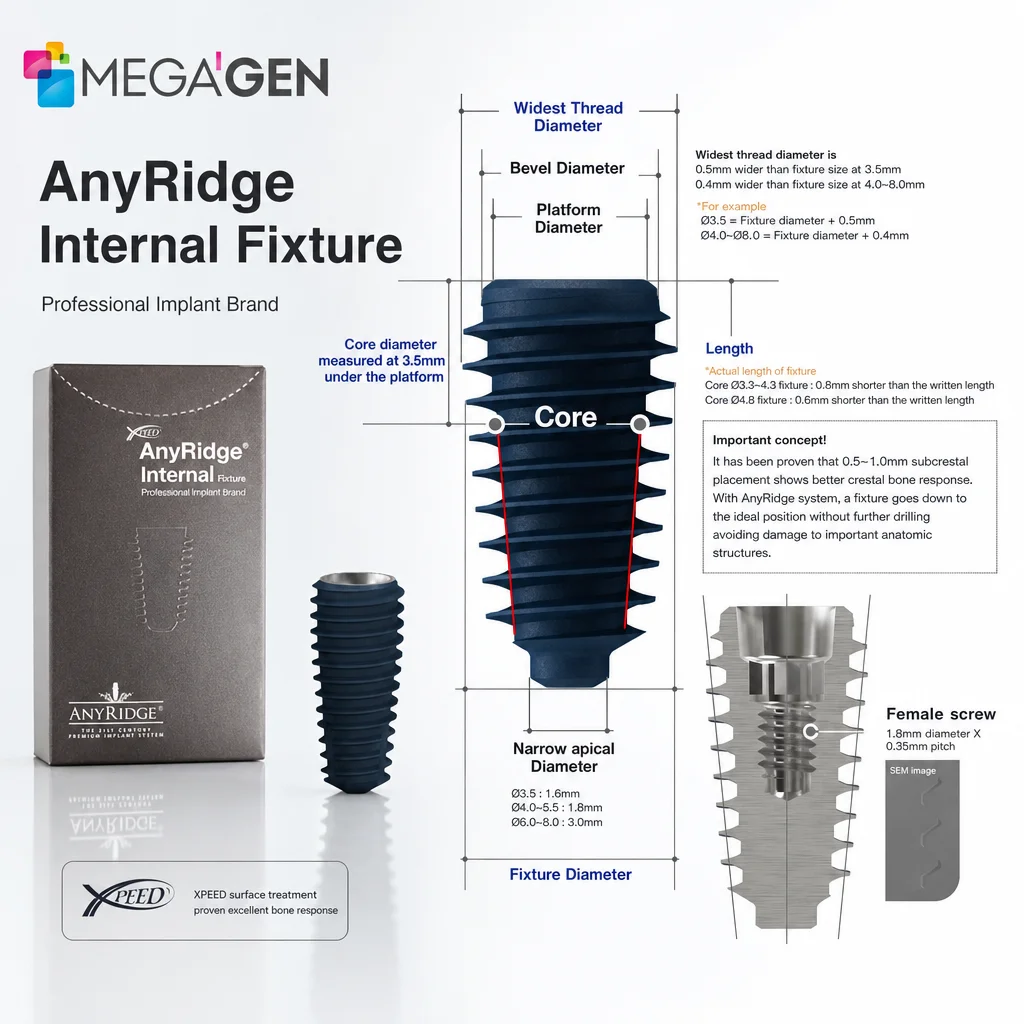 MegaGen AnyRidge XPEED Impiant, Osseospeed Surface, Internal Hex Titanium Root Body, D4.0xL10.0 Threaded for Bone Repair