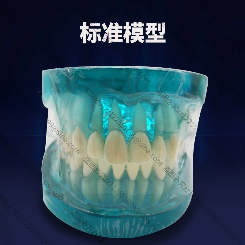 Suitable for Teaching Model Detachable Teaching Ready Denture Model Ornament