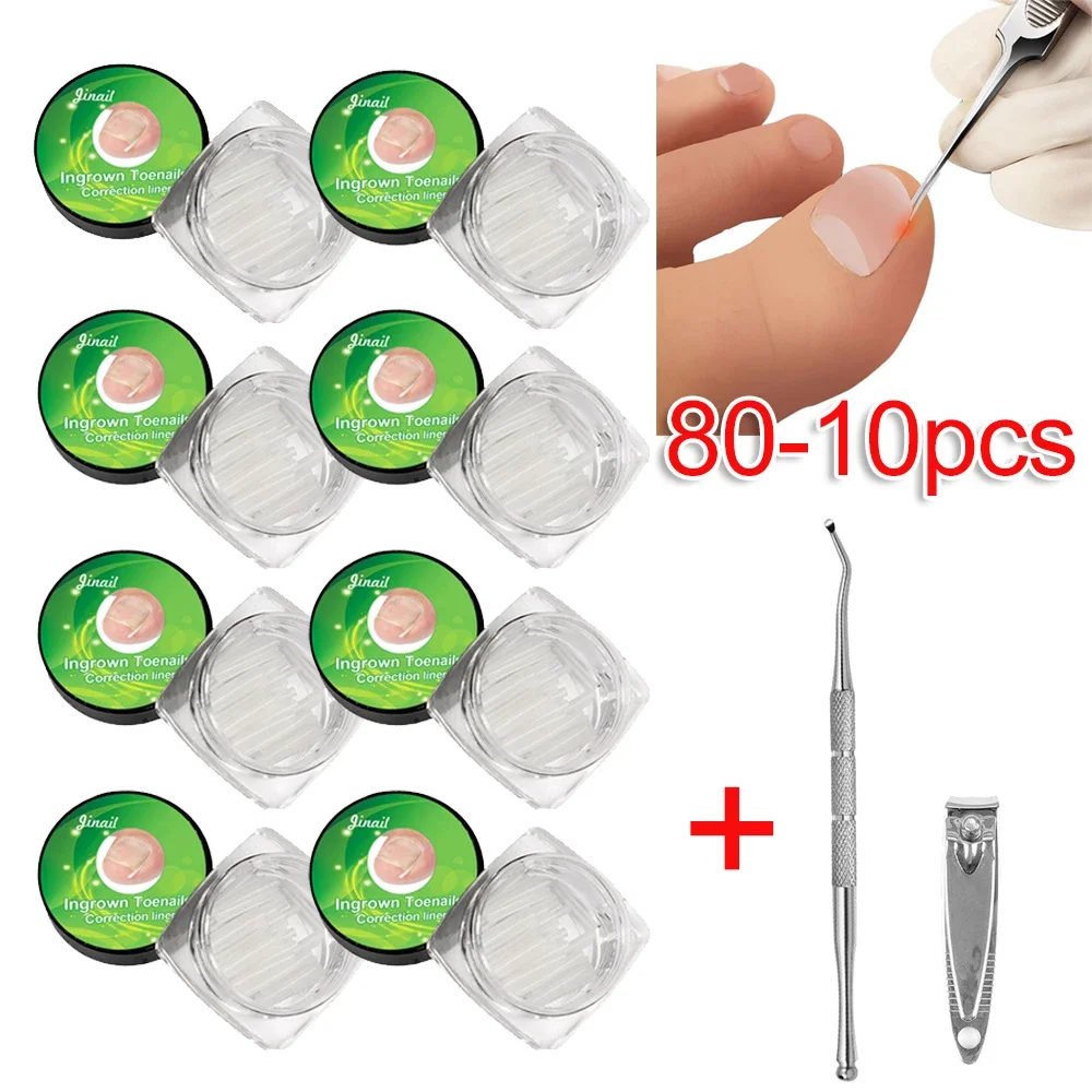 80-10 個陥入爪矯正ツール陥入爪治療弾性パッチステッカー矯正クリップブレースペディキュアツール