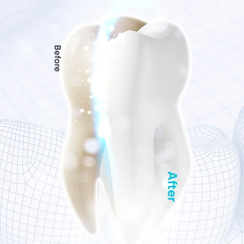 Zähne Bleaching Pulver 50g Kaffee Wein Rauchen Fleck Entfernen Aufheller Ohne Verursachung Schäden, Halten Oral Frische