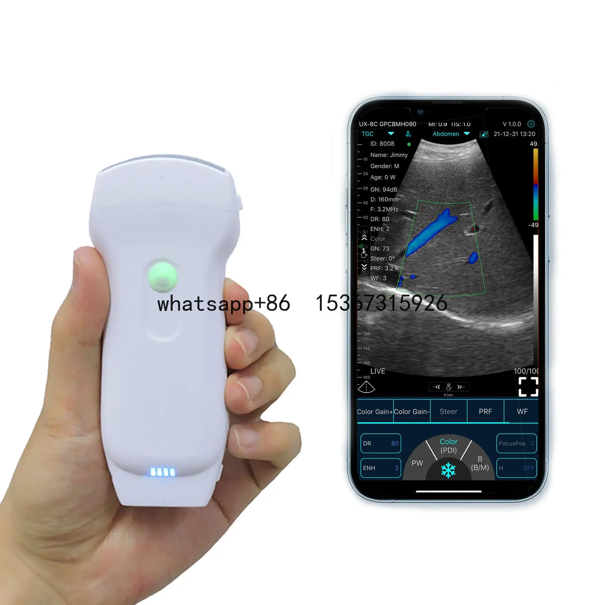 Handheld wireless ultrasound Wireless Probe USB&wifi wireless ultrasound Transudcer detecting for vessel/abdomen/heart