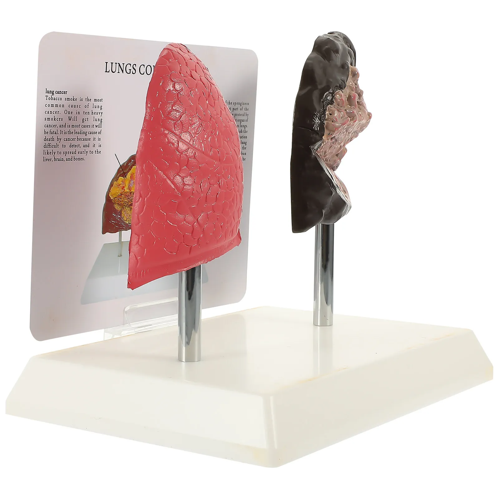 

Модель легких для сравнения с нормальной анатомией легких (1 шт.) – учебное пособие для изучения дыхательной системы в медицинских учреждениях