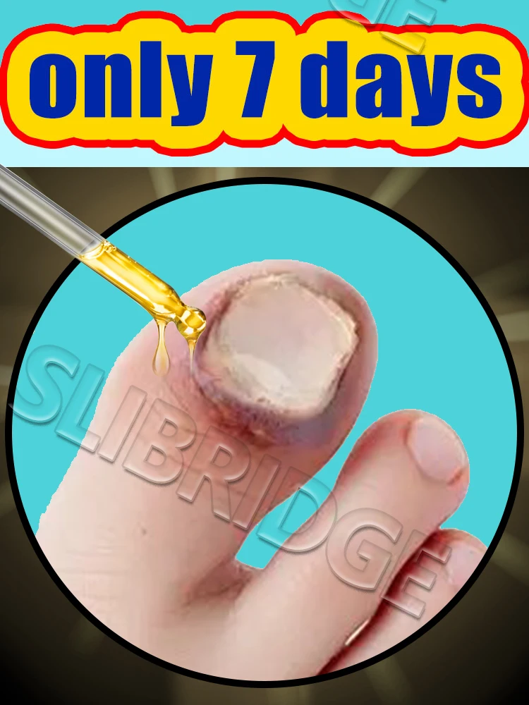 

Hot cleaning nail brush tools, plastic vacuum cleaners, Say goodbye to nail troubles more discounts on sets