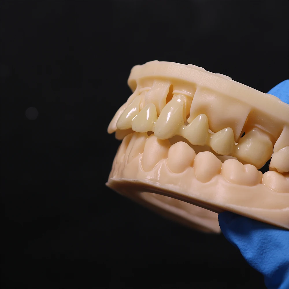 IFun 3160Lab Resin | 405nm 3D Printing Photosensitive Polymer DLP Printer Material for High Precision Lab Models