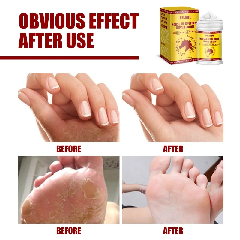 Horse Oil Hand Foot Skin Repair Moisturizer Cream Anti Chapping peeling Rough Dry Cracked Chapped  Exfoliating Feet Heel care