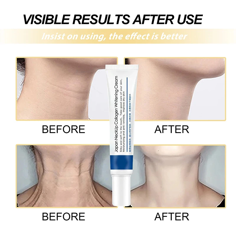 Neck Lines Protein Cream Eliminate Double Chin Eliminate Neck Fine Lines Moisturis Nourish Lift Neck Anti-ageing Rejuvenation