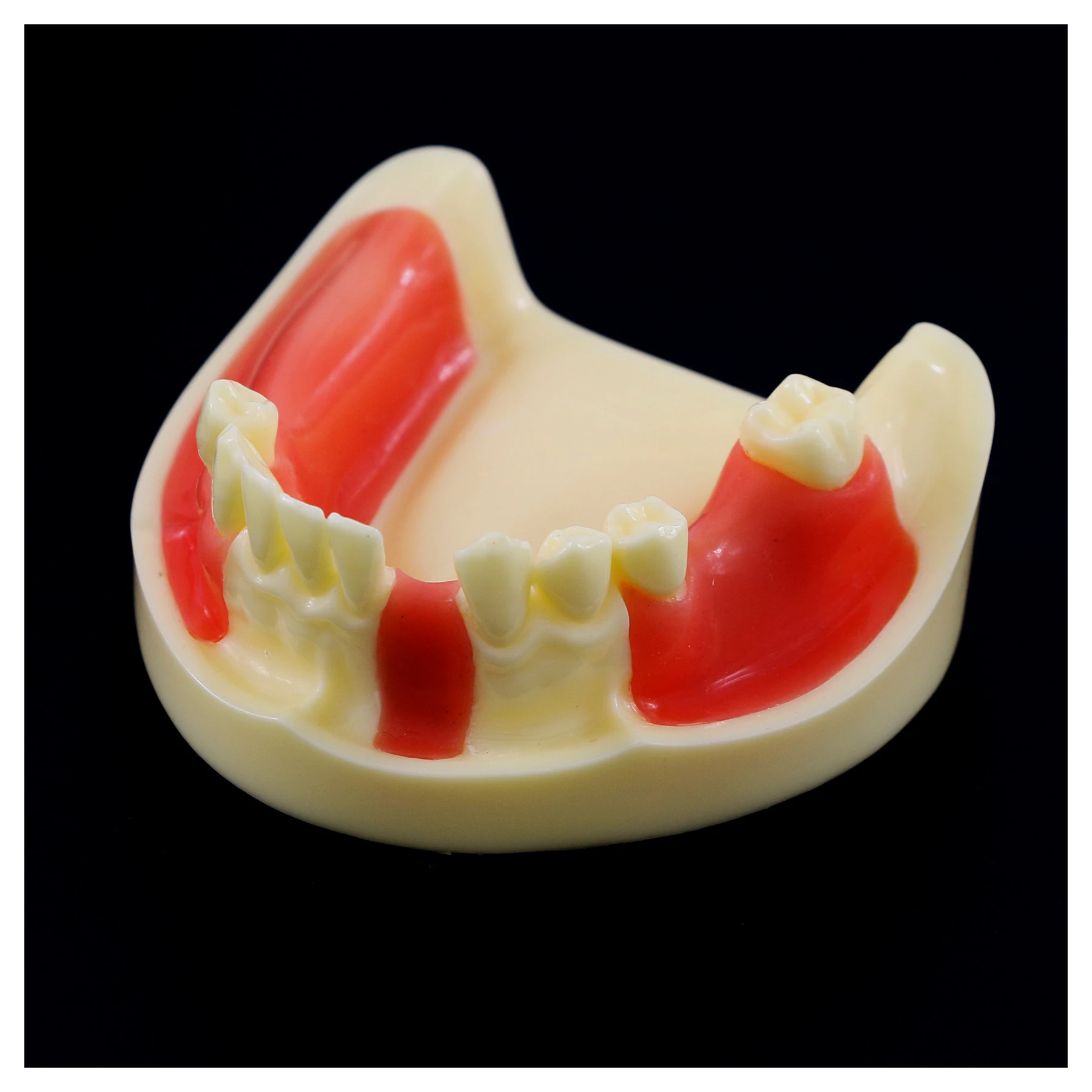 

Dental Teeth Model Typodont M2004 Implant Practice Overdenture Restoration Low Jaw Demo For Studying Teaching