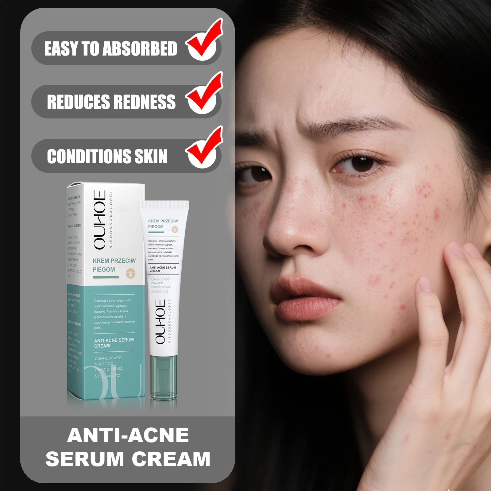 OUHOE Anti-Acne Serum Cream Gentle Formula Conditions Skin Texture Improves Oiliness Clean Pores Make Breathable & Refreshing