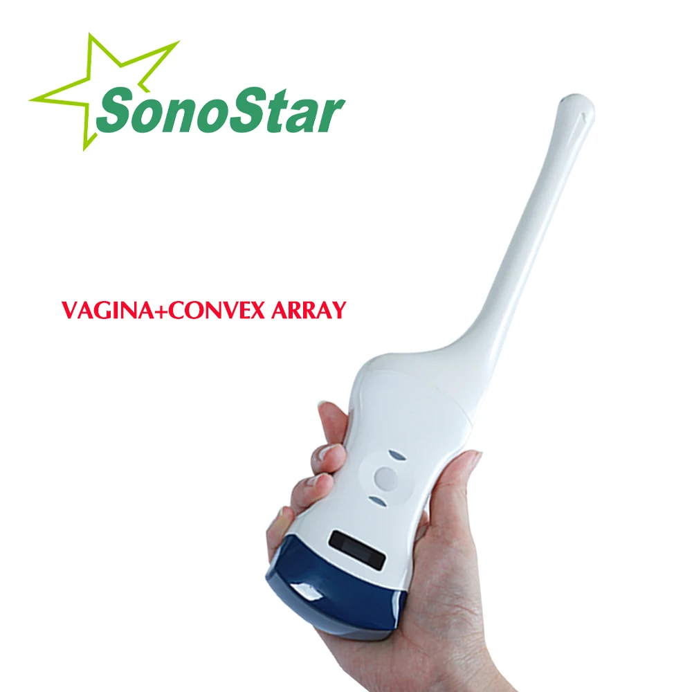 

Беспроводной ультразвуковой сканер Sonostar: портативный эндоскопический датчик для гинекологии, прямой кишки и влагалища, с выпуклой матрицей и цветным допплером