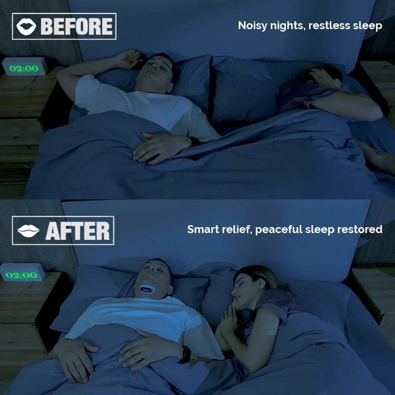 YA4600 Smart Anti Snoring Magnetic Patch Snore Stopper Electric Throat Muscle Stimulator Massager No Snoring Sleepping Aids