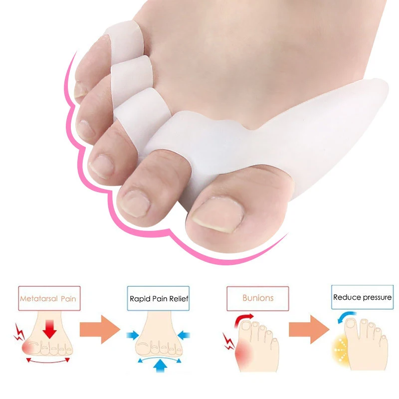 Pexmen 2 sztuk/para Gel separatory palców do korygowania Bunions i przywracania palców w oryginalnym kształcie Bunion wkładka korekcyjna na palce ochraniacze