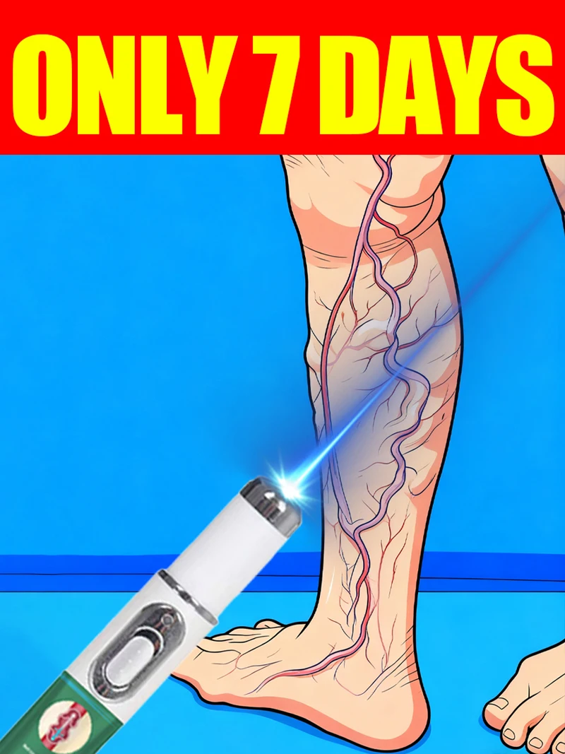 قلم الوريد بالليزر يزيل الدوالي من الجسم #1