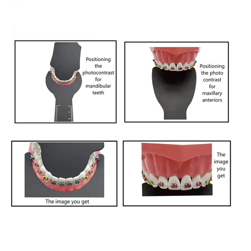 치과용 사진 대조 블랙 배경 보드, 오토클레이브 사진 대조, 구강 뺨 플레이트, 블랙 배경 보드, 1PC