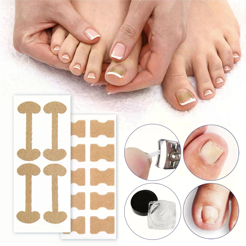 Professional Ingrown Toenail Foot Corrector Stickers Set Toe Nail Care Pedicure Tools Health Care Protects Paronychia Treatment
