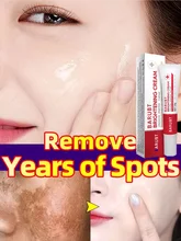 Removal Melasma Dark Spots Whitening Freckles Face Cream Corrector Lighten Melanin Pigmentation Brighten Anti-Aging Beauty Care