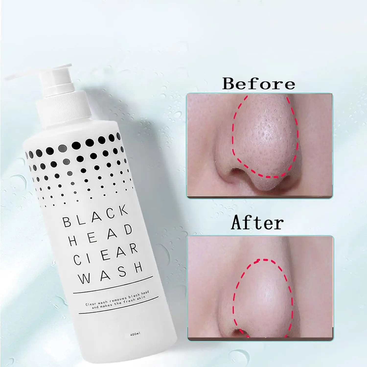 2PCS Neus Mee-eter Verwijdering Vloeistof T-Zone Diepe Reiniging Huidverzorging Porie Minimizer 400ml Peeling Oplossing Gezichtsreinigingsvloeistof