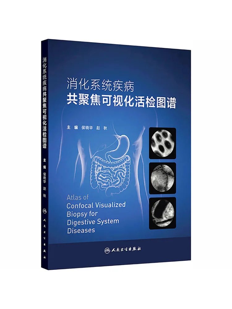 Book-Winshare Co Focal Visualization Atlas Of Digestive System Diseases
