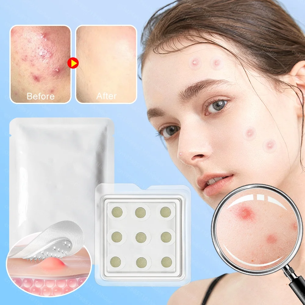 

Microneedles Hyaluronic Acid Acne Patch Invisible Beauty Concealer Breathable Facial Care Mild and Non Irritating Clean Pores