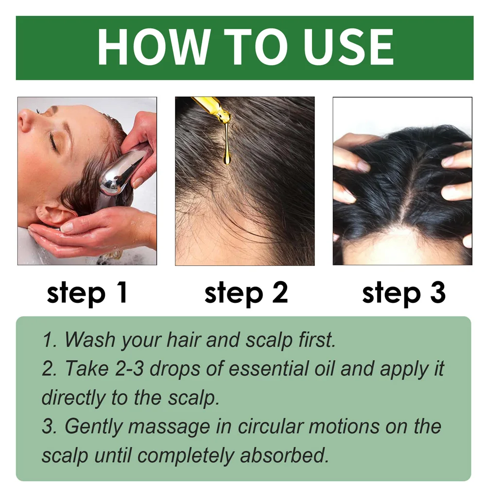 Ginger Hair Essence Anti Hair Loss Prevention Hair Loss Hair Care Essential Oil Scalp Care Beauty Health Care Men and Women