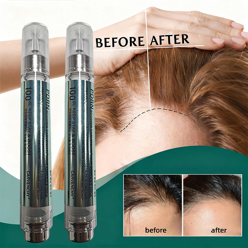 

Новая бестселлерная сыворотка для волос, глубокий коллаген, интенсивное лечение, успокаивает питает кожу головы, уменьшает выпадение волос, брендовое лечение волос