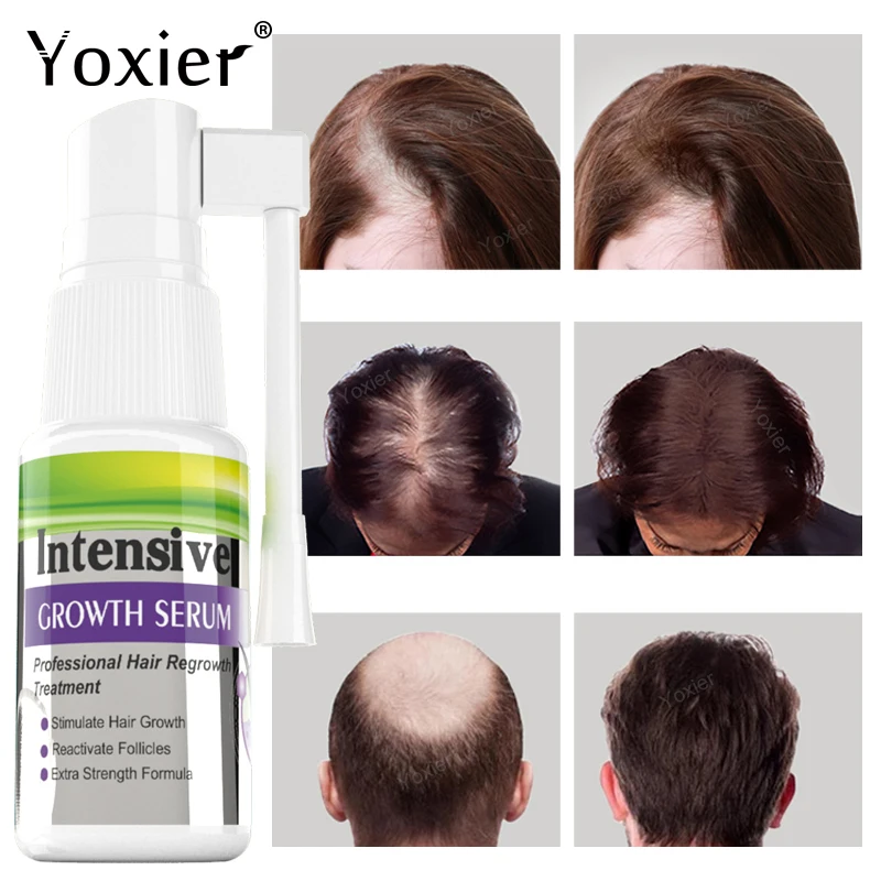 Intensive Growth Serum Spray Anti Hair Loss Prevent Baldness Repair Damaged Fast Regrowth Ginger Healthy Thick Scalp Treatment