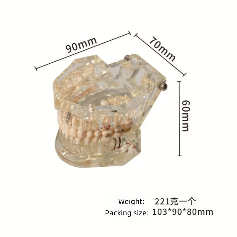 1 PC Implant Dental Model Pathological Dental Model Detachable Oral Model Bridge Connected Explanation Model Dental Guard