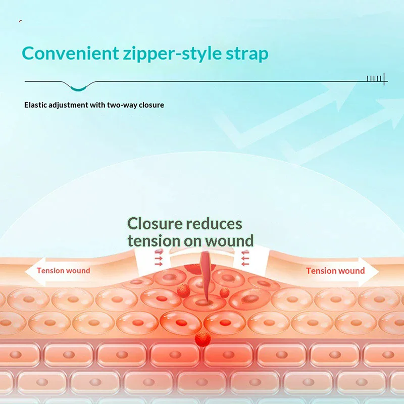 

Пластырь-застежка для безболезненного закрытия ран, пластырь для закрытия ран без швов, пластырь-застежка для уменьшения швов, портативный для использования на улице