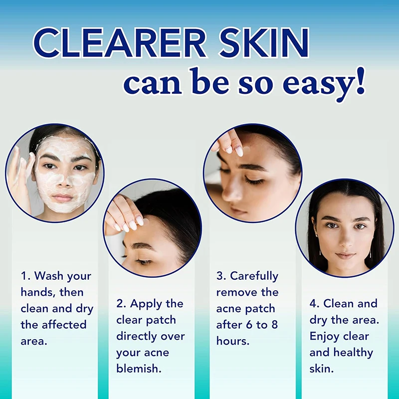 

360pcs Pimple Patch Acne Invisible Acne Removal Skin Care Stickers Concealer Face Spot Beauty Makeup Tools