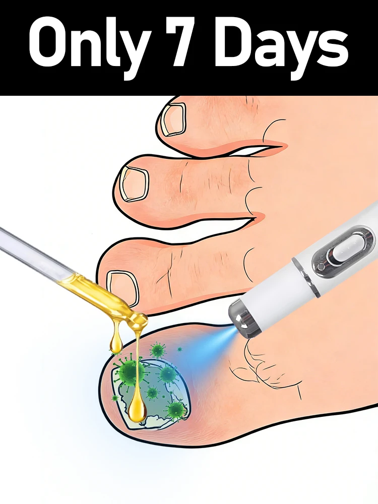 

Generation-2,7 days helping people who for nail solve their problems,Hot sale